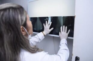 Centro de Controle Oncológico busca mais de 1,5 mil pacientes que não retiraram resultados de exames