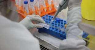 Estado disponibiliza exames para monkeypox