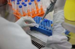 Estado disponibiliza exames para monkeypox