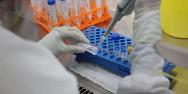 Estado disponibiliza exames para monkeypox