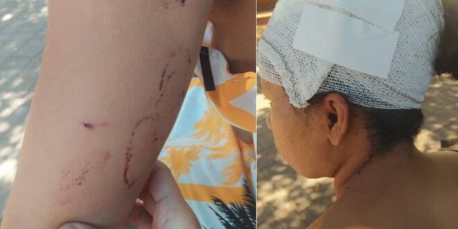 Homem é preso por tentativa de feminicídio em Rio Branco