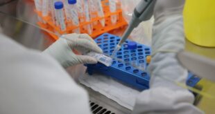 Saúde notifica mais um caso suspeito de monkeypox no Acre