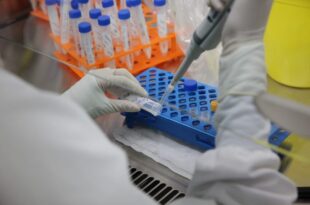 Saúde notifica mais um caso suspeito de monkeypox no Acre