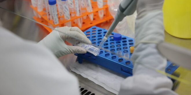 Saúde notifica mais um caso suspeito de monkeypox no Acre