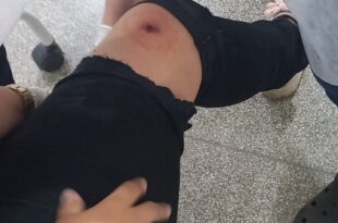 Mulher é ferida a tiros por assaltante em plena luz do dia