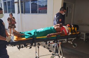 Motociclista fica em estado grave após acidente em ramal de Rio Branco