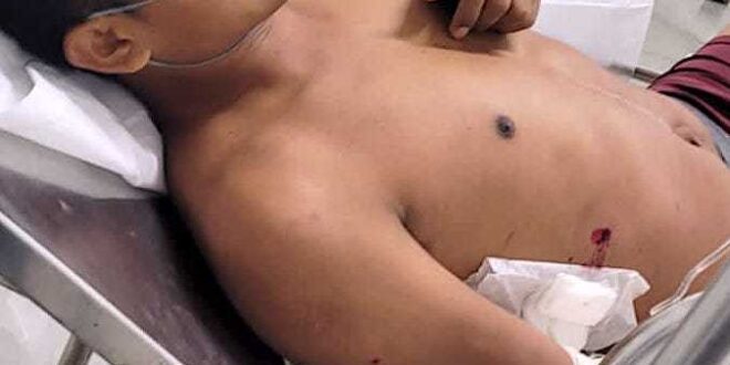 Violência: homem é baleado pelas costas em Brasileia