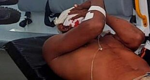 Violência em família: discussão por cachaça termina em facadas