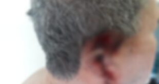 Apresenta namorada à esposa e tem orelha decepada