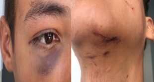 No Acre: Agentes de segurança são suspeitos de torturar adolescentes na região do Juruá