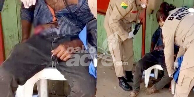 Atacado a faca fica com o intestino exposto em Epitaciolândia