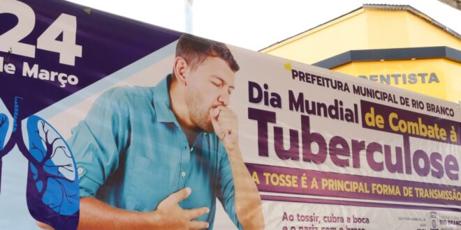 Governo do Acre e prefeituras promovem Semana Nacional de Mobilização e Luta contra a Tuberculose