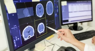 Covid-19 pode ter efeitos semelhantes à esquizofrenia e aumentar risco de diabetes
