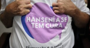 Tarauacá passa a realizar análise local para detecção de hanseníase
