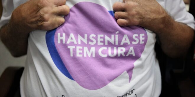 Tarauacá passa a realizar análise local para detecção de hanseníase