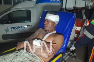 Homem é encontrado com parte do crânio exposto após agressão