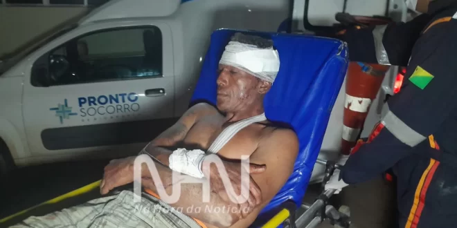 Homem é encontrado com parte do crânio exposto após agressão