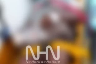 Mulher é agredida, tem perna quebrada e dedo amputado como pagamento de dívida