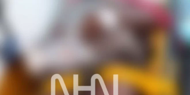 Mulher é agredida, tem perna quebrada e dedo amputado como pagamento de dívida