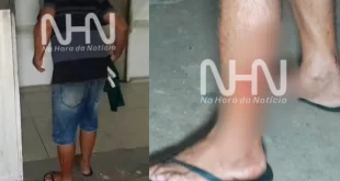 Vítima de tentativa de latrocínio corre até o PS em busca de ajuda