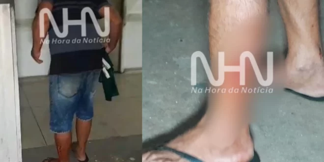 Vítima de tentativa de latrocínio corre até o PS em busca de ajuda