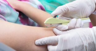 Acre vai ofertar DIU Mirena e implante subdérmico para adolescentes entre 14 e 18 anos