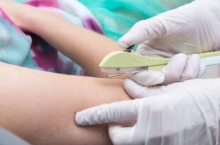 Acre vai ofertar DIU Mirena e implante subdérmico para adolescentes entre 14 e 18 anos