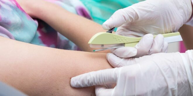 Acre vai ofertar DIU Mirena e implante subdérmico para adolescentes entre 14 e 18 anos