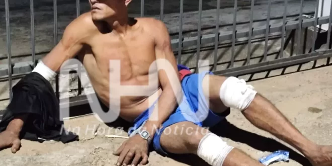 Homem é linchado pela população após roubar