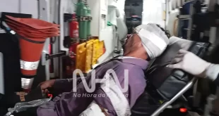 Lâmina de roçadeira quebra e fica cravada na testa de trabalhador