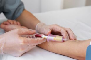 Exame é capaz de diagnosticar Alzheimer 10 anos antes dos sintomas