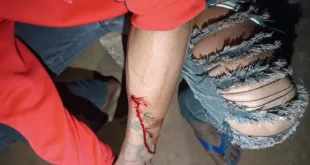 Ava guaranis de TI demarcada pela Funai no PR continuam sob ataque; 4 são baleados
