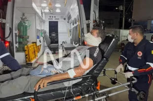 Espingarda explode no rosto de colono, e cano da arma fica cravado no rosto da vítima