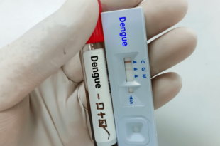Sesacre anuncia chegada de 47,5 mil testes rápidos para o diagnóstico de dengue