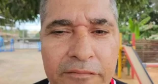 Líder do CV é ferido a tiros