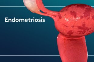Acre lança ambulatório especializado no tratamento da endometriose