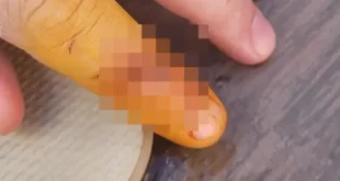 Balneário em Bonito (MS) é interditado após peixe comer dedo de banhista