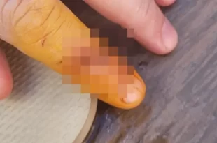 Balneário em Bonito (MS) é interditado após peixe comer dedo de banhista