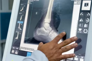 Farra das emendas: Amapá recebeu valor suficiente para examinar 98% de sua população