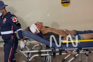 Violência em Rio Branco: agredido com ripas de madeira sofre fratura exposta