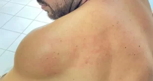 Violência política: vereador denuncia agressão física por colega parlamentar