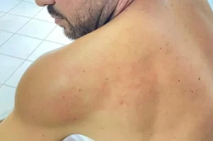 Violência política: vereador denuncia agressão física por colega parlamentar