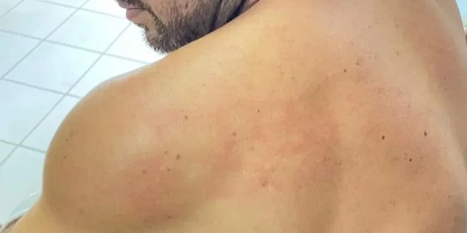 Violência política: vereador denuncia agressão física por colega parlamentar