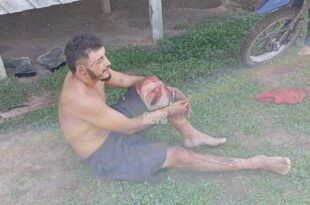 Violência no Acre: tio mata sobrinho durante bebedeira entre familiares