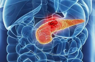 Bem viver: médico alerta sobre hábito que mais prejudica o pâncreas