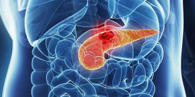 Bem viver: médico alerta sobre hábito que mais prejudica o pâncreas