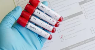 Alerta: gonorreia está se tornando cada vez mais resistente a antibióticos
