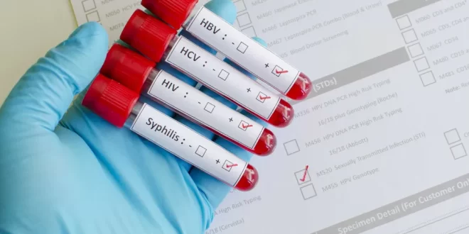 Alerta: gonorreia está se tornando cada vez mais resistente a antibióticos