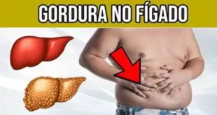 Bem Viver: como a gordura se acumula no fígado e onde ela se instala no órgão