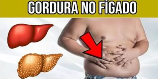 Bem Viver: como a gordura se acumula no fígado e onde ela se instala no órgão